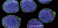 Viewpoint: ‘Organoid intelligence’?—Ethical questions arise in using organoid human brain nuggets to study disease