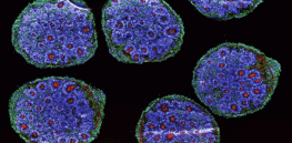 Viewpoint: ‘Organoid intelligence’?—Ethical questions arise in using organoid human brain nuggets to study disease