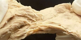 GM mushrooms taste like meat but use 70% less land than livestock 