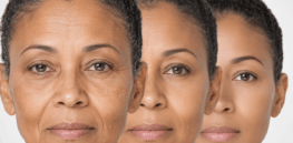 Longevity: Is cellular rejuvenation even possible?