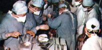 From printers to pigs: The precarious future of organ transplants