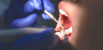 Would you go to a holistic dentist? It’s either a scam or a dentist trying to sell you unnecessary supplements.