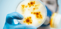 Viewpoint: Long-contained diseases are on the rise in the U.S. Are Trump cuts to blame?