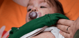 ‘The child is terrified’: Doctors on the front lines of a measles comeback speak out