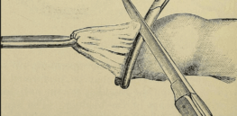Debunking another RFK Jr. autism myth: No, circumcision cannot cause autism