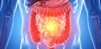 Three weird ‘gut hacks’ currently coursing through social media that don’t work–and could be dangerous