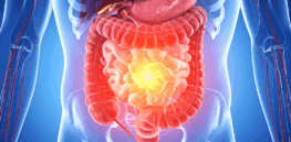 Three weird ‘gut hacks’ currently coursing through social media that don’t work–and could be dangerous
