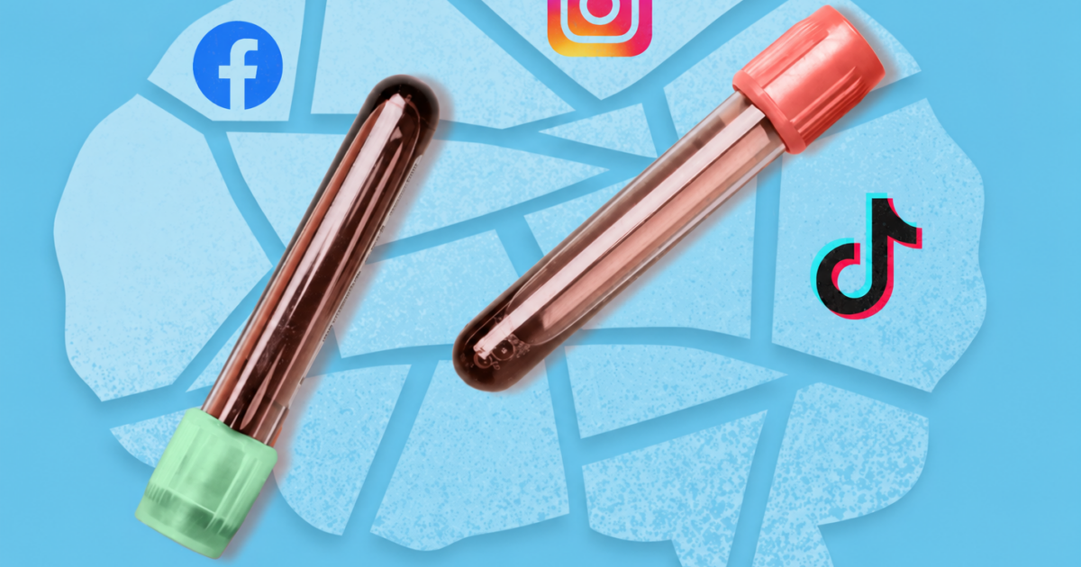 Blood tests for Alzheimer’s? The latest grifter, social media scam.