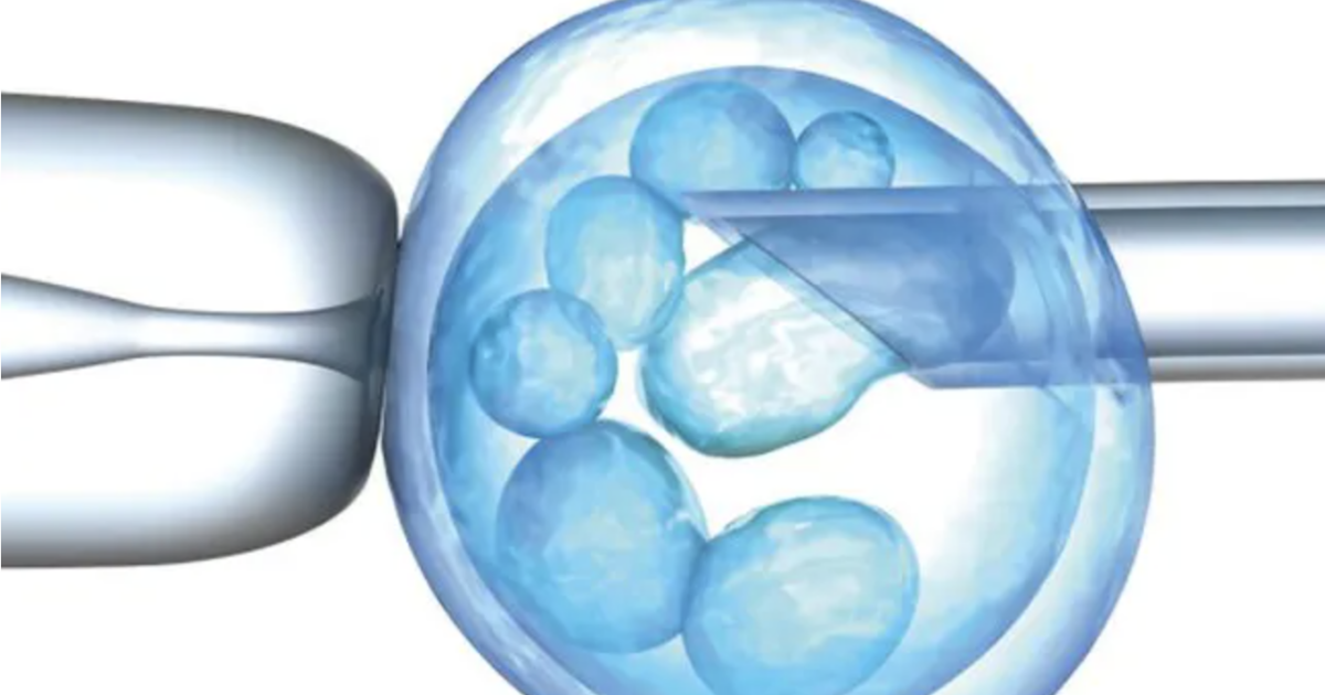 Viewpoint: Selective pronatalism: The radical “ethical” case challenging parents’ right to end a pregnancy when a fetus has a severe genetic disorder
