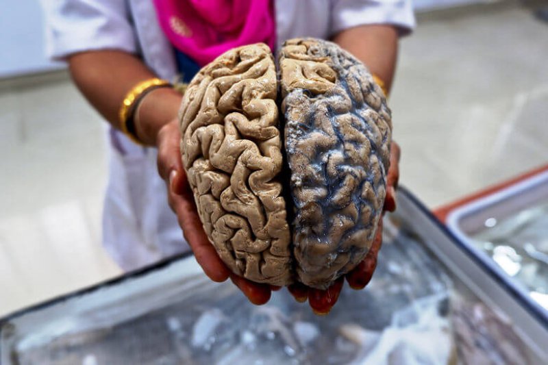 a formalin fixed human brain ready to be handed to visitors