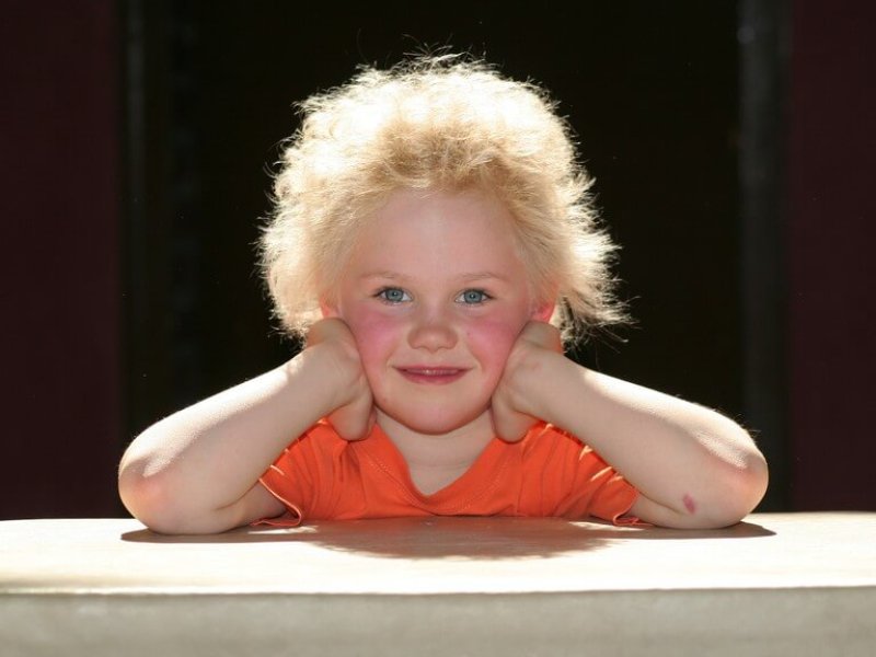 A child with uncombable hair syndrome. Credit: University of Bonn