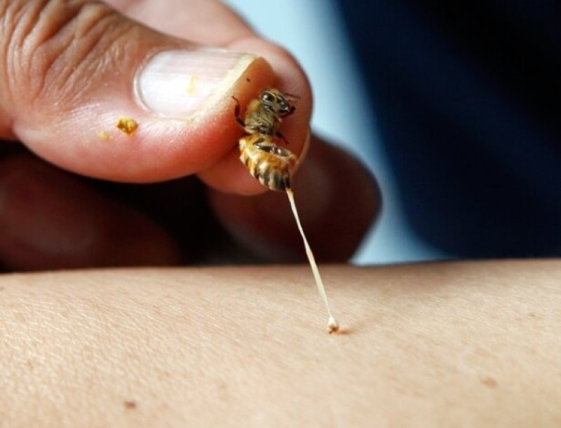 jun abelha pica braco de um paciente na fazenda de abelhas em silang nas filipinas joel magsaysay usa o veneno das abelhas para curar pacientes com doencas com