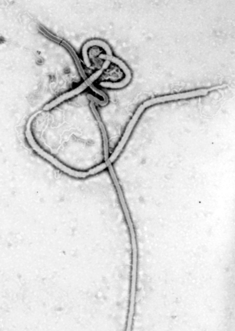 px Ebola virus em