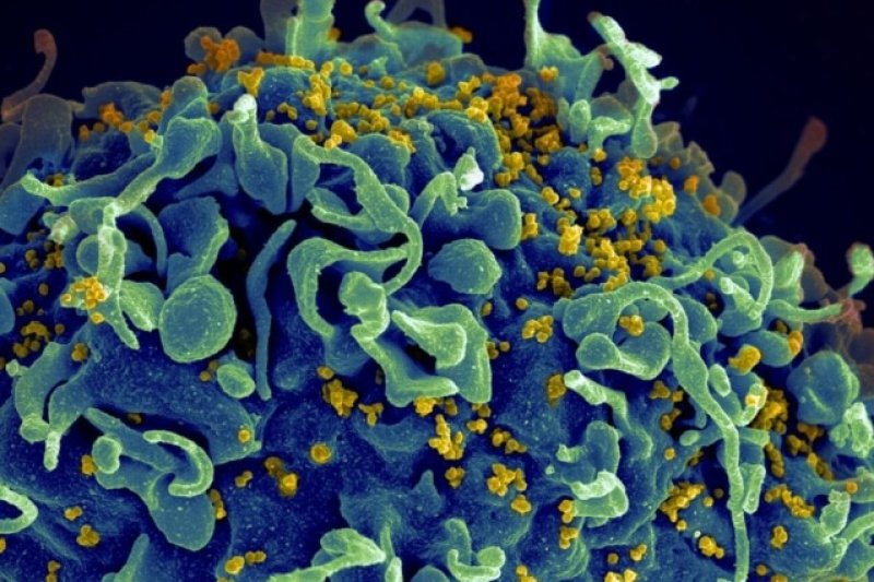 MIT HIV Vaccine