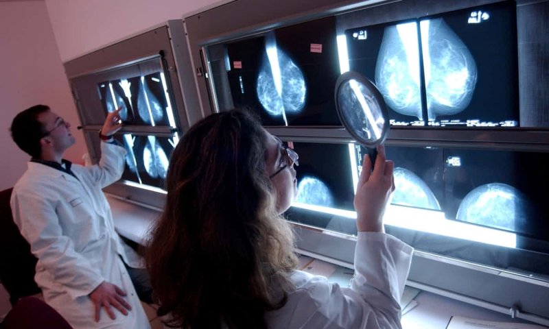 Medics screen scans for breast cancer. Image: Garo/Phanie/Rex/Shutterstock