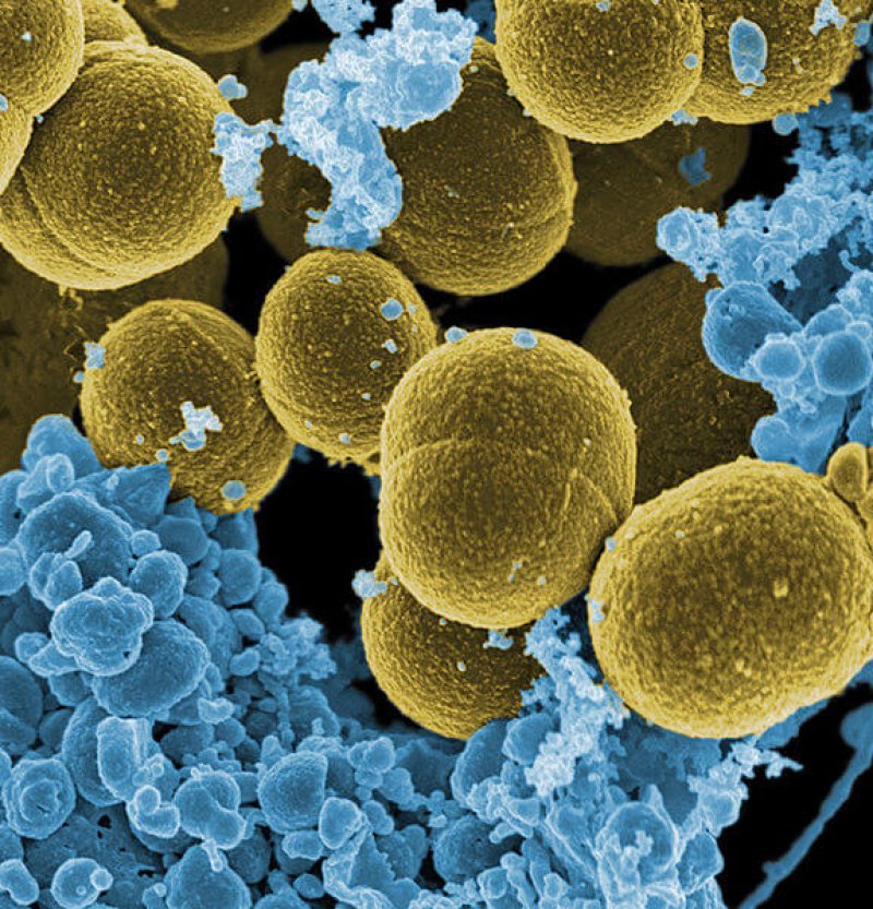 px Staphylococcus aureus bacteria escape