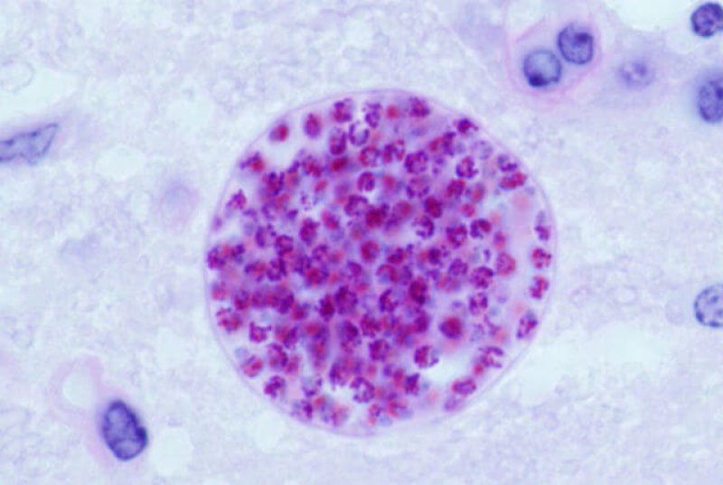 px Toxoplasma gondii tissue cyst in mouse brain