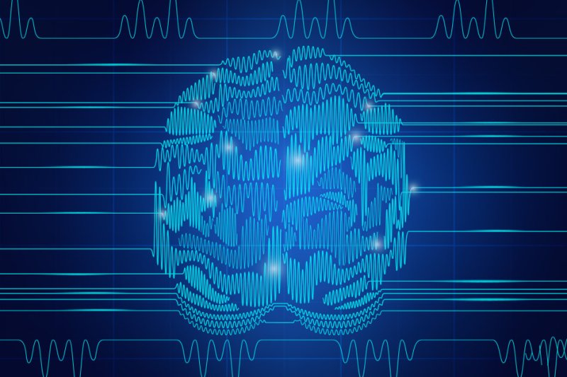 MIT Brain Rhythms