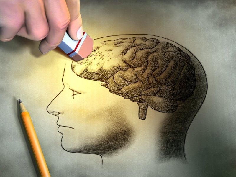 Alzheimer’s