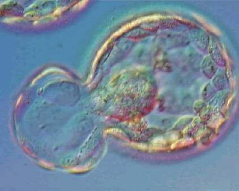 Breakthrough in Stem Cell Research and Female Infertility Treatment