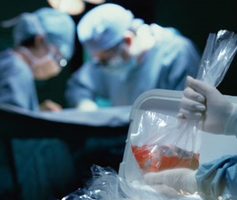 Human organ transplant