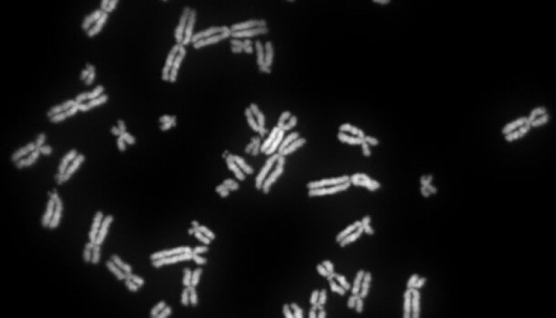 Human female metaphase chromosomes tif x