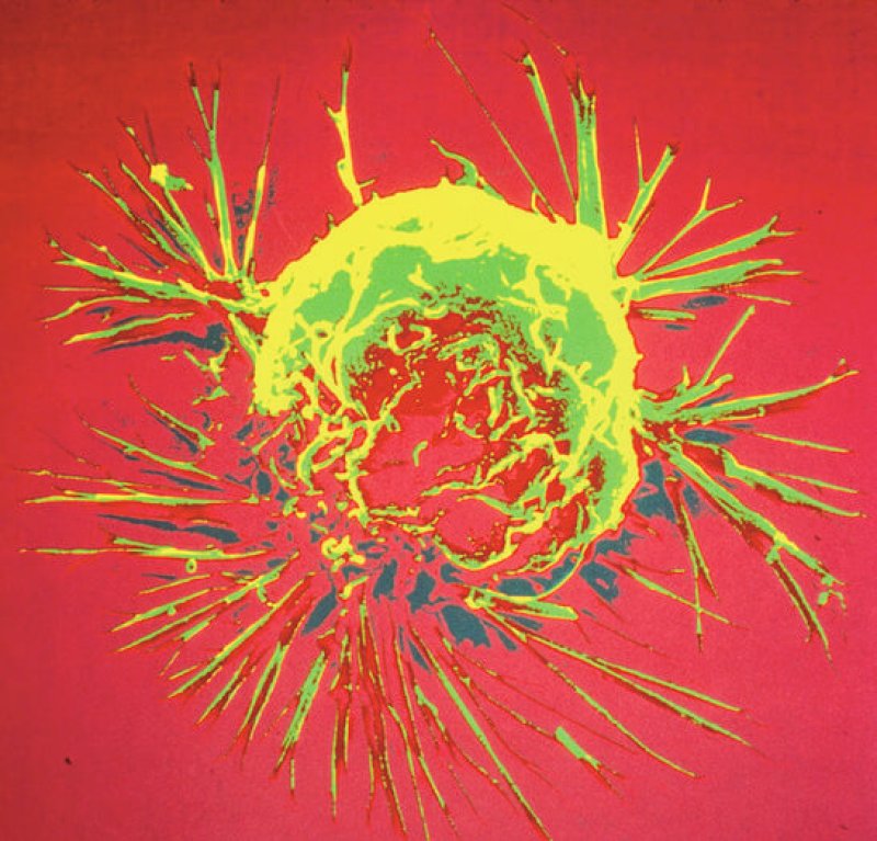 NIH cancer cell