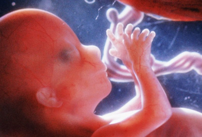 PRinc photo of fetus at weeks