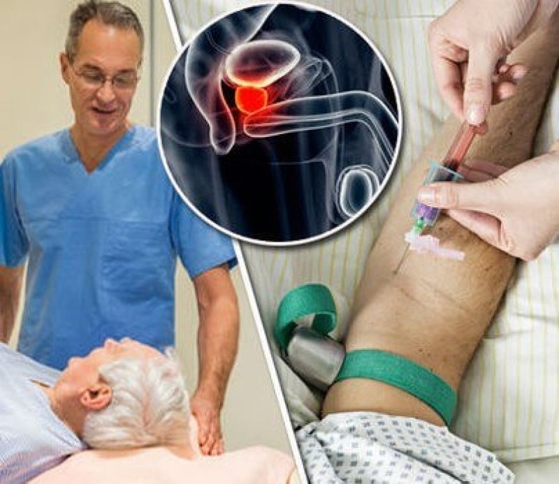 Prostate cancer Blood test could diagnose disease
