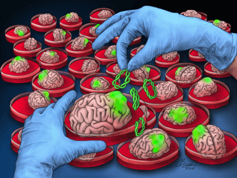 COVID infected mini brains may help shape the treatment for long COVID
