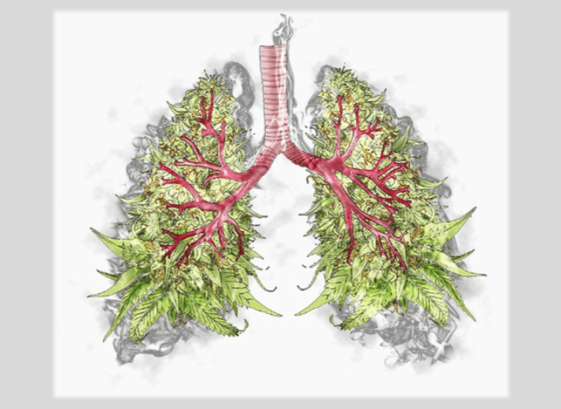 Smoking weed increase risk of developing emphysema