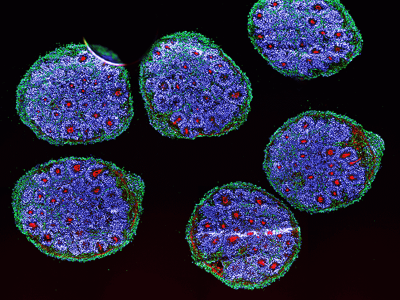 Credit: Harvard/ Noelia Anton Bolanos and Irene Faravelli