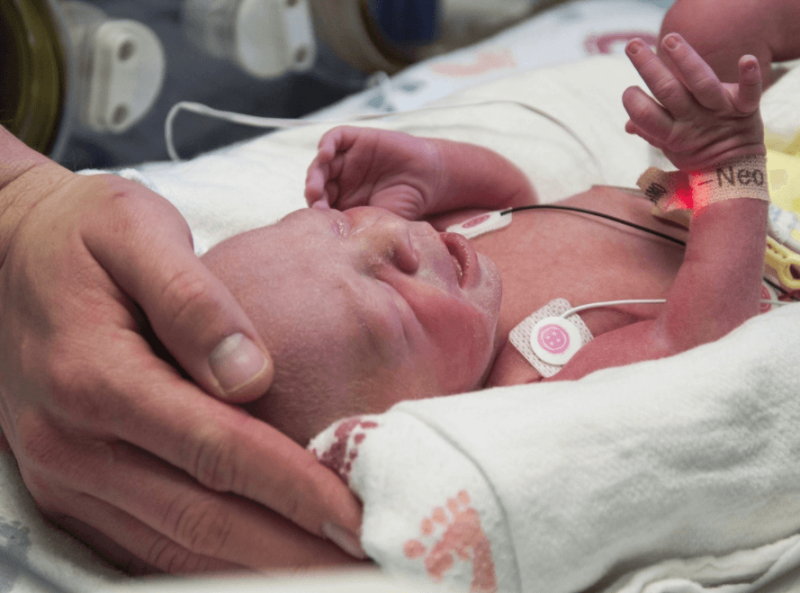 The first baby born as a result of a womb transplant in the United States in the neonatal unit at Baylor University Medical Center in Dallas. Credit: AP
AP