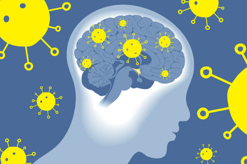 long COVID linked to brain abnormalities up to 6 months after infection