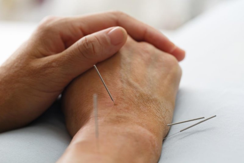 acupuncture on wrist