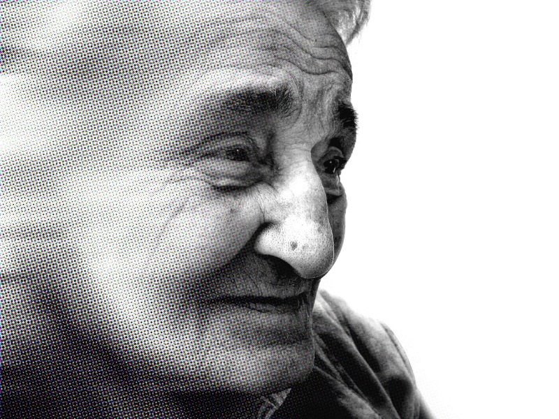 age age spots alzheimer s