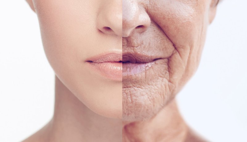 aging