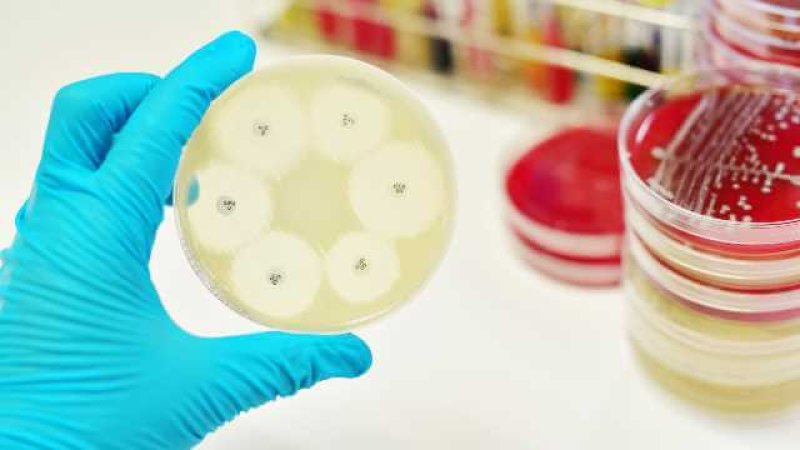 antimicrobial resistance the rise of global superbugs