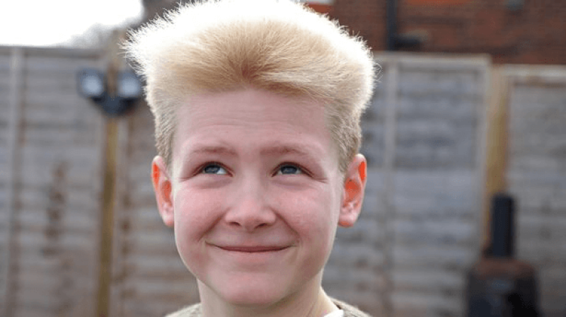 It looks like you stuck your finger in an electric socket': 10-year-old  finds pride in 'uncombable hair' syndrome tied to genetic mutation -  Genetic Literacy Project