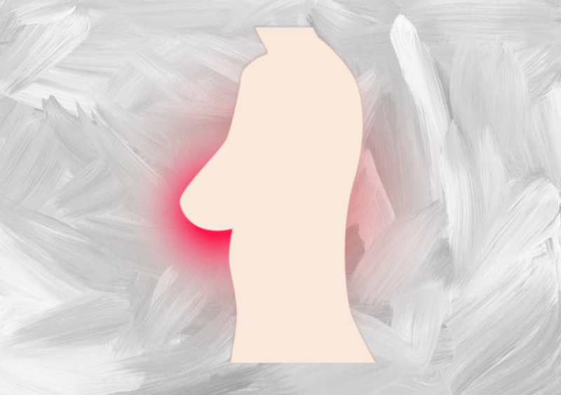 do women with larger breasts face a greater risk of cancer?