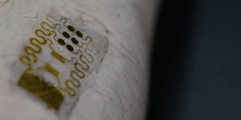 smart bandages that can monitor wounds as they heal
