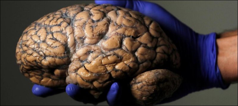 brain featured