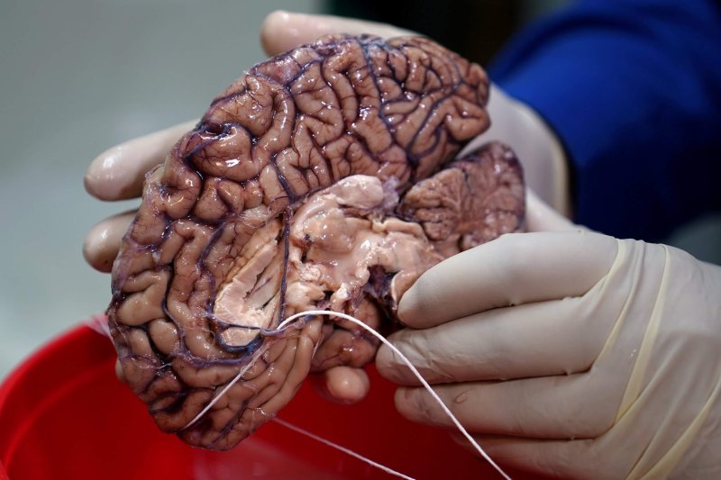 brain