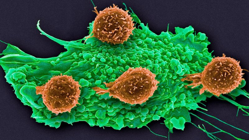 ca nid t cell cancer online