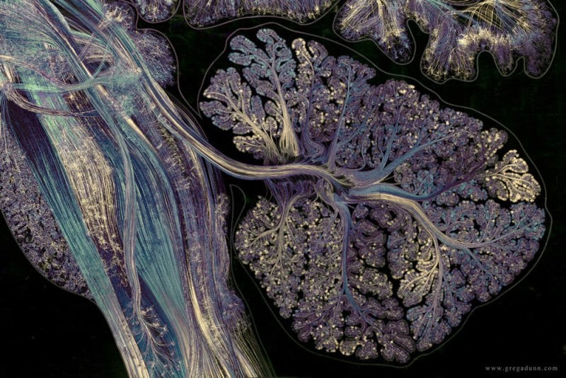 The cross-sectioned cerebellum. Credit: Greg Dunn and Will Drinker