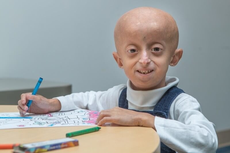 Credit: Progeria Research Foundation