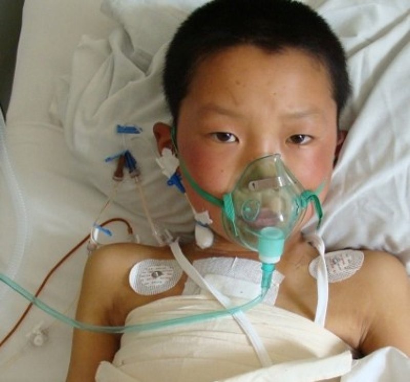 children heart disease radiation risks of cancer