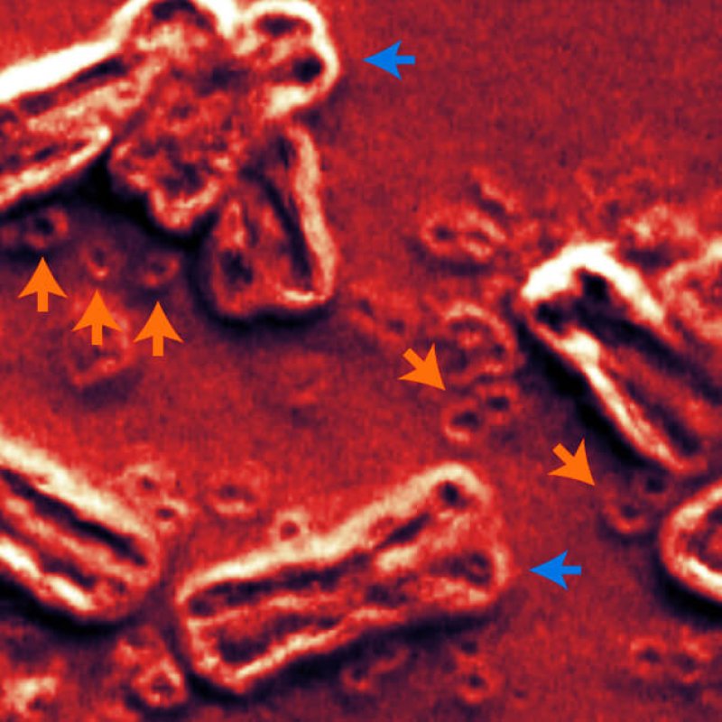 circular cancer dna mischel a