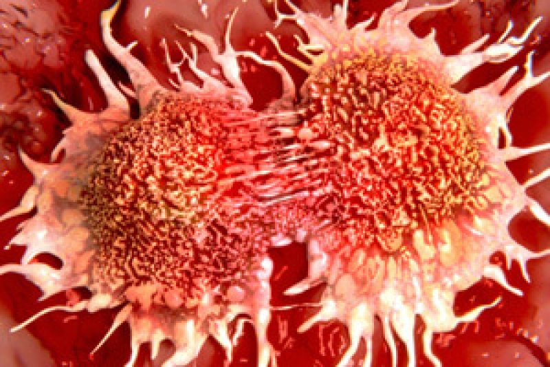 dividing cancer cells