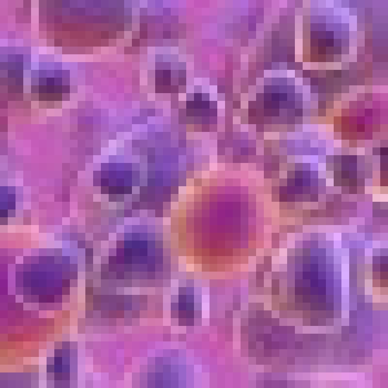 e Stem Cell Therapy Breast Tissues x